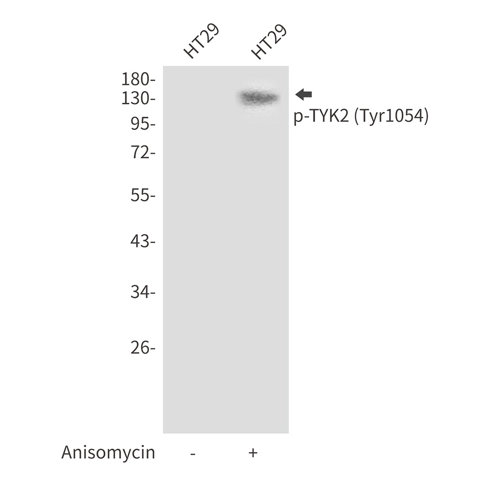 Anti-Phospho-TYK2 (Tyr1054) Rabbit Polyclonal Antibody
