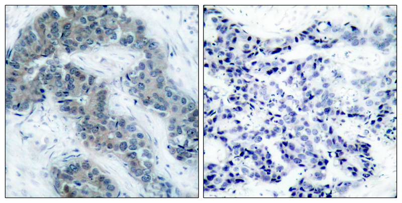 Anti-Phospho-JAK2 (Tyr1007) Rabbit Polyclonal Antibody