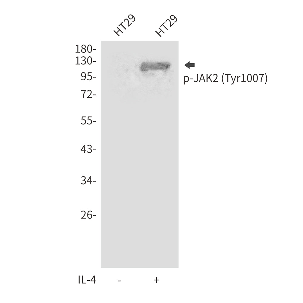 Anti-Phospho-JAK2 (Tyr1007) Rabbit Polyclonal Antibody