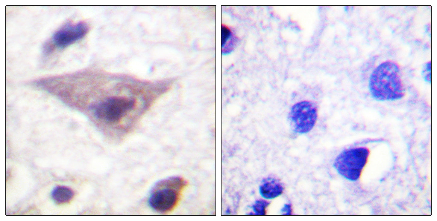 Anti-Phospho-alpha Synuclein (Ser129) Rabbit Polyclonal Antibody