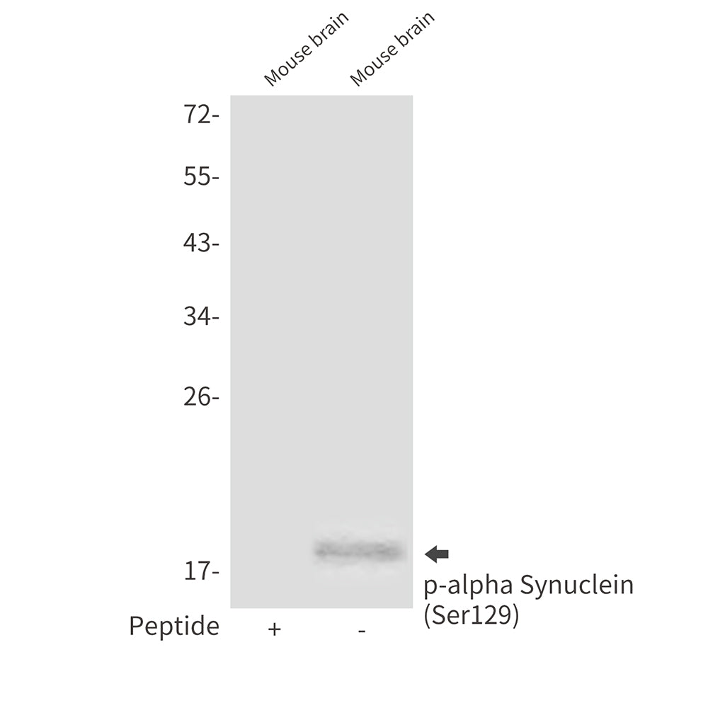 Anti-Phospho-alpha Synuclein (Ser129) Rabbit Polyclonal Antibody