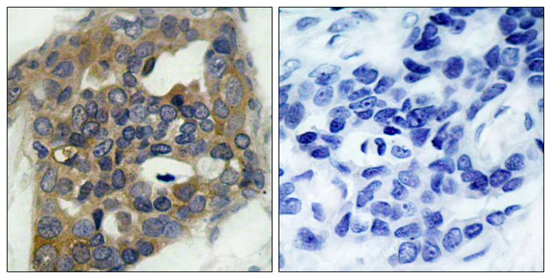 Anti-Phospho-ASK1 (Ser966) Rabbit Polyclonal Antibody