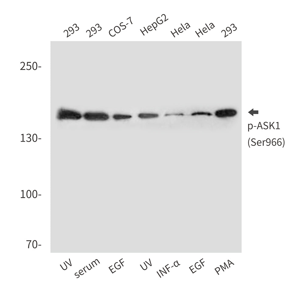 Anti-Phospho-ASK1 (Ser966) Rabbit Polyclonal Antibody