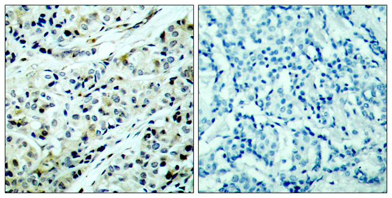 Anti-Phospho-HDAC5 (Ser498) Rabbit Polyclonal Antibody