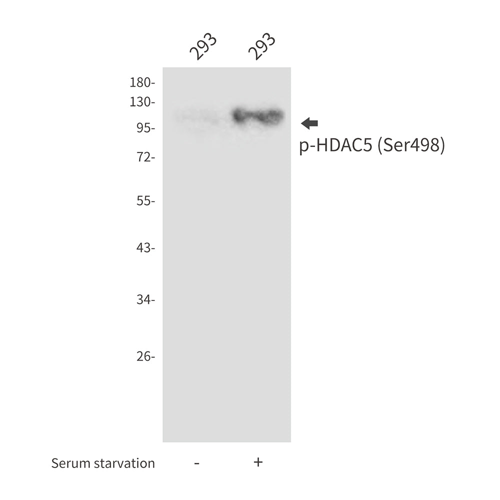 Anti-Phospho-HDAC5 (Ser498) Rabbit Polyclonal Antibody