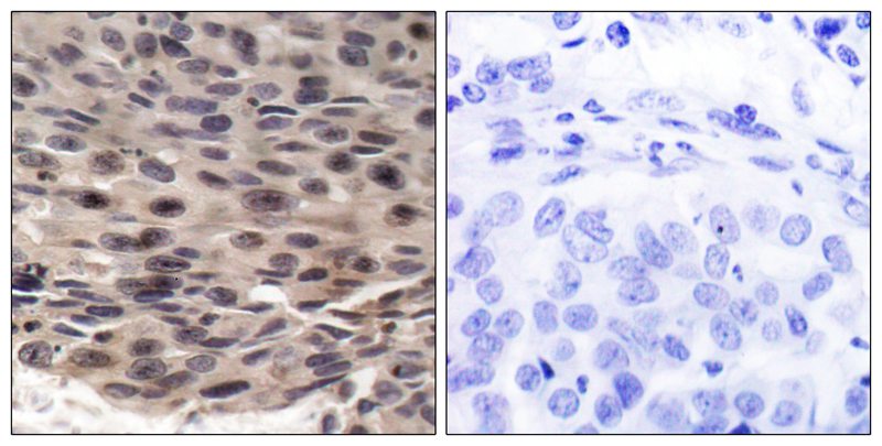 Anti-Phospho-4E BP1 (Thr37) Rabbit Polyclonal Antibody