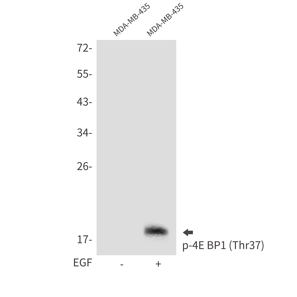 Anti-Phospho-4E BP1 (Thr37) Rabbit Polyclonal Antibody