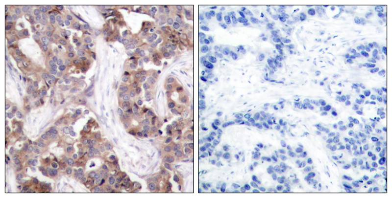 Anti-Phospho-Stathmin 1 (Ser25) Rabbit Polyclonal Antibody