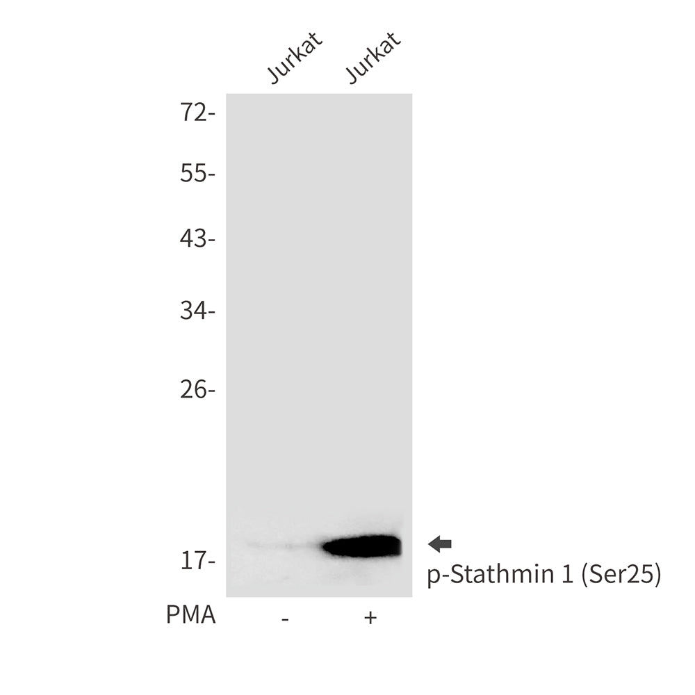 Anti-Phospho-Stathmin 1 (Ser25) Rabbit Polyclonal Antibody