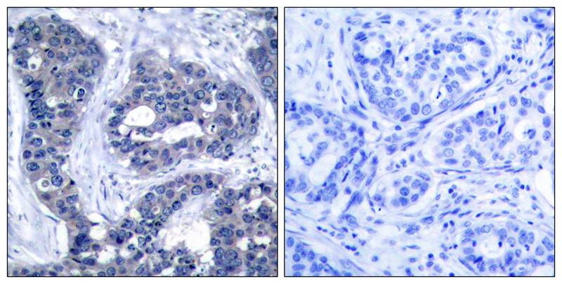 Anti-Phospho-IRS1 (Ser639) Rabbit Polyclonal Antibody