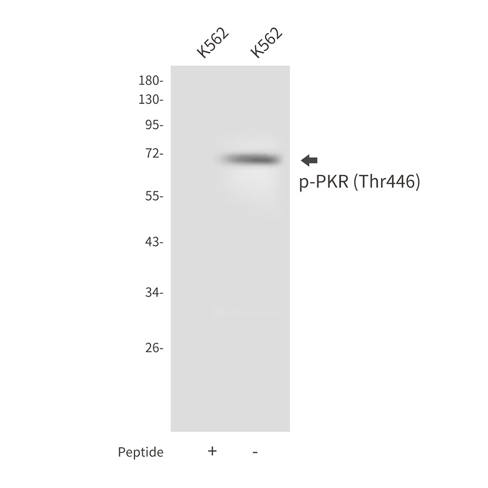 Anti-Phospho-PKR (Thr446) Rabbit Polyclonal Antibody