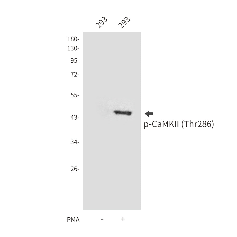 Anti-Phospho-CaMKII (Thr286) Rabbit Polyclonal Antibody