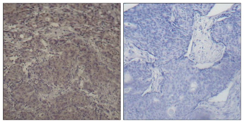 Anti-Phospho-CREB (Ser142) Rabbit Polyclonal Antibody