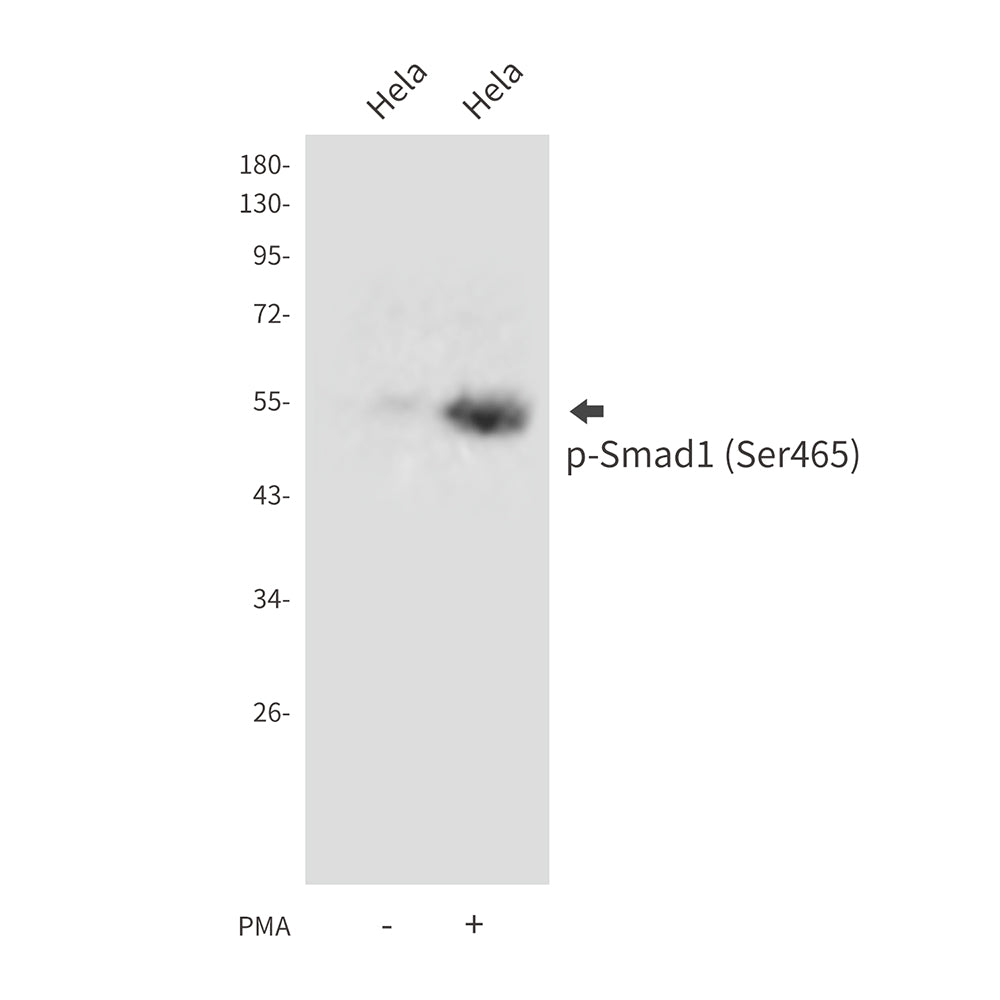 Anti-Phospho-Smad1 (Ser465) Rabbit Polyclonal Antibody