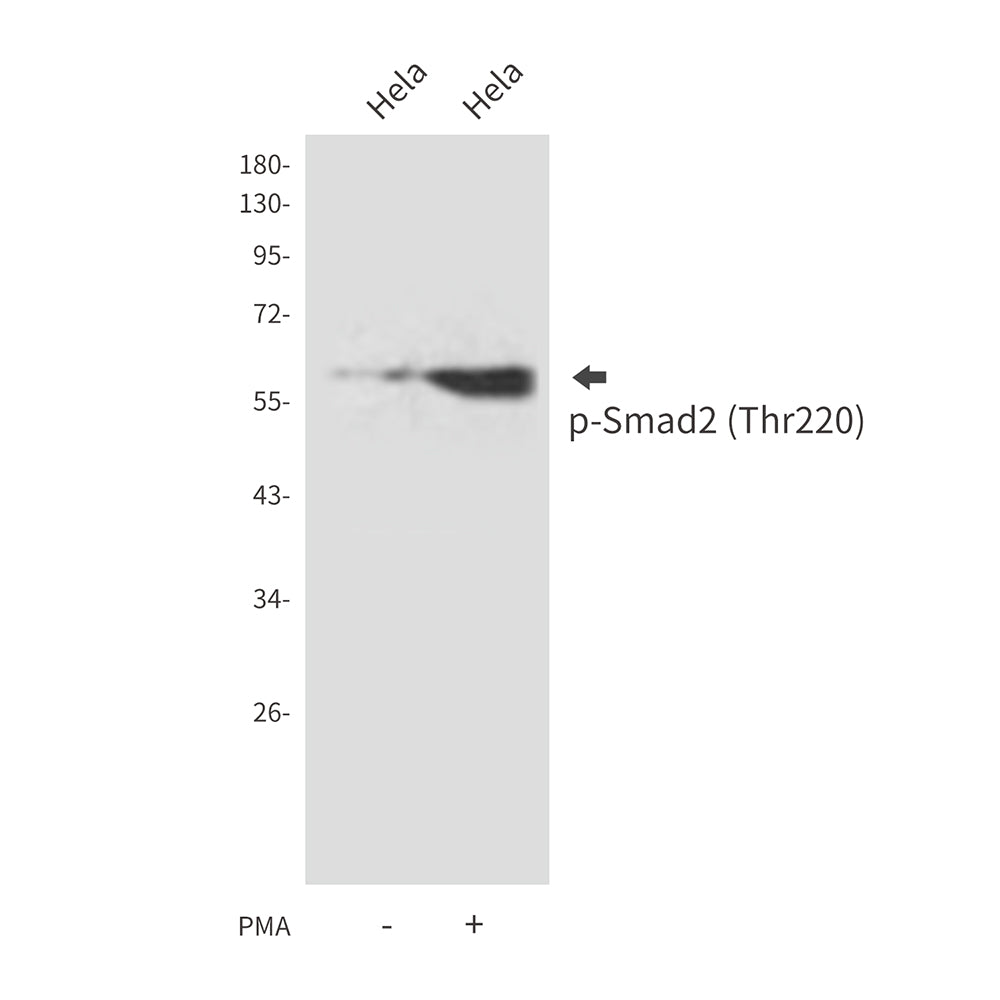 Anti-Phospho-Smad2 (Thr220) Rabbit Polyclonal Antibody