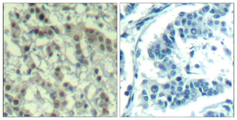 Anti-Phospho-Aurora A (Thr288) Rabbit Polyclonal Antibody