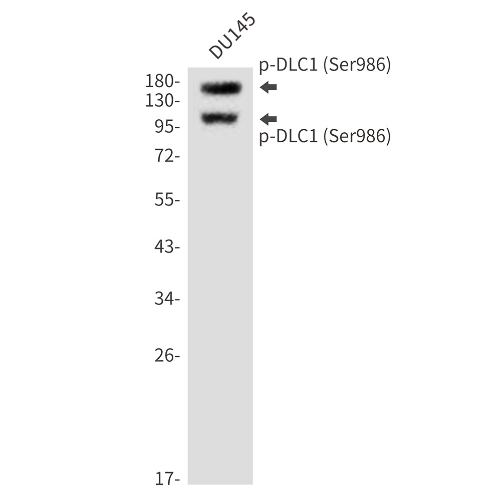 Anti-Phospho-DLC1 (Ser986) Rabbit Polyclonal Antibody