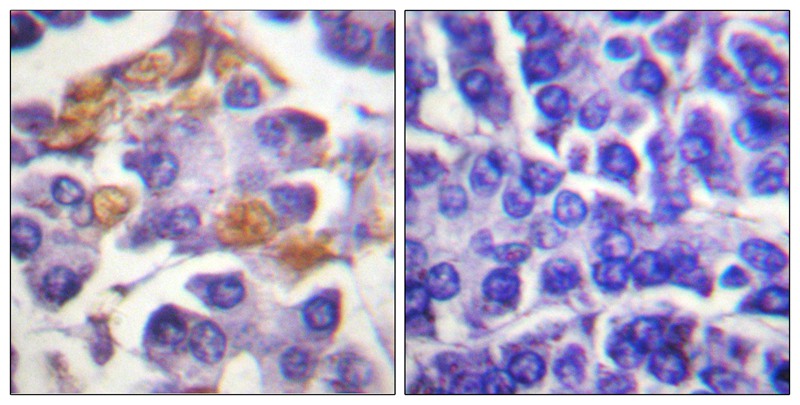 Anti-Phospho-Raf1 (Tyr341) Rabbit Polyclonal Antibody