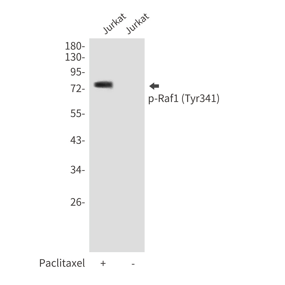 Anti-Phospho-Raf1 (Tyr341) Rabbit Polyclonal Antibody