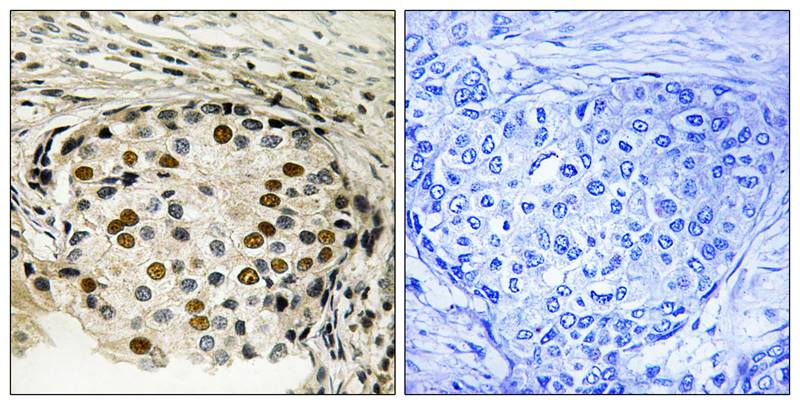 Anti-Phospho-OXSR1 (Thr185) Rabbit Polyclonal Antibody