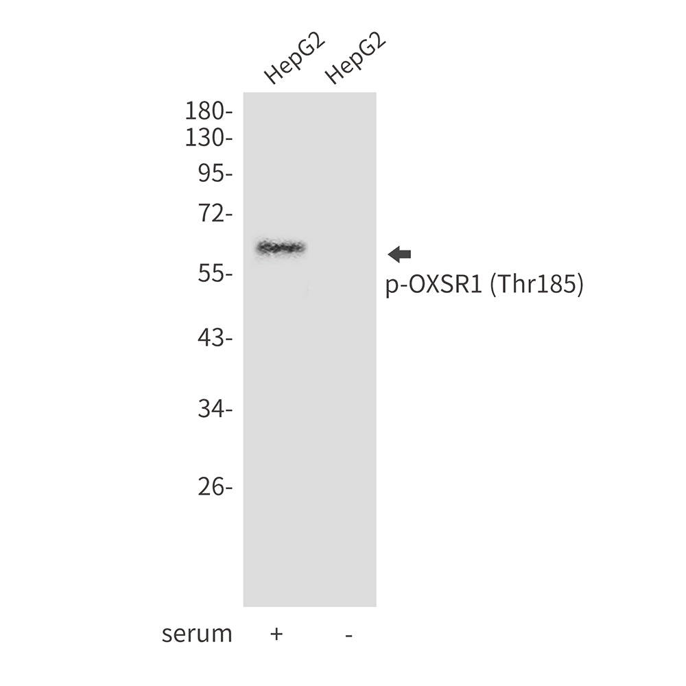 Anti-Phospho-OXSR1 (Thr185) Rabbit Polyclonal Antibody