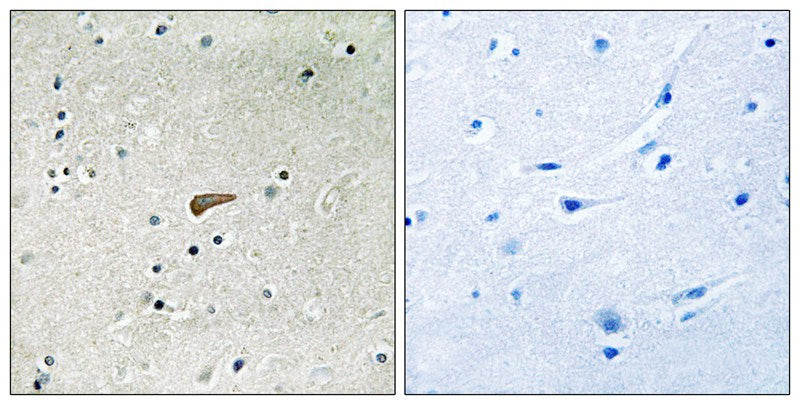 Anti-Phospho-FRS2 (Tyr436) Rabbit Polyclonal Antibody