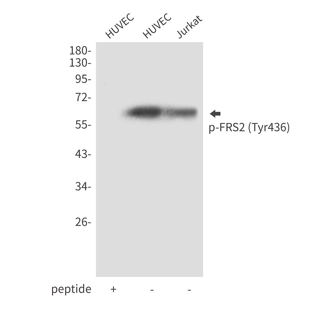 Anti-Phospho-FRS2 (Tyr436) Rabbit Polyclonal Antibody