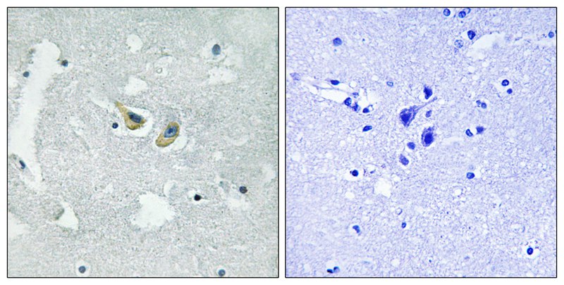 Anti-Phospho-NCF1 (Ser345) Rabbit Polyclonal Antibody