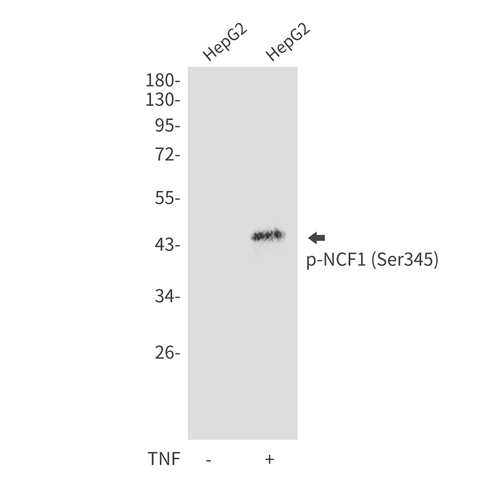 Anti-Phospho-NCF1 (Ser345) Rabbit Polyclonal Antibody