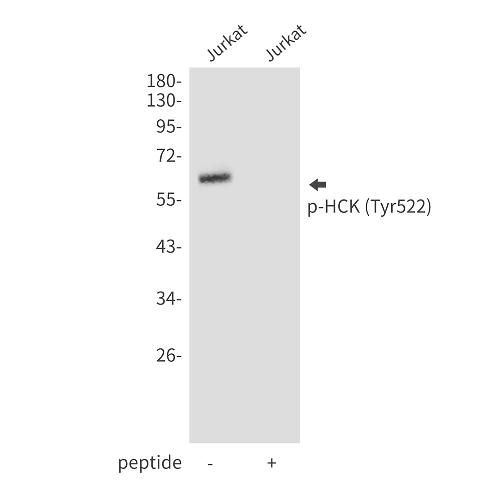 Anti-Phospho-HCK (Tyr522) Rabbit Polyclonal Antibody