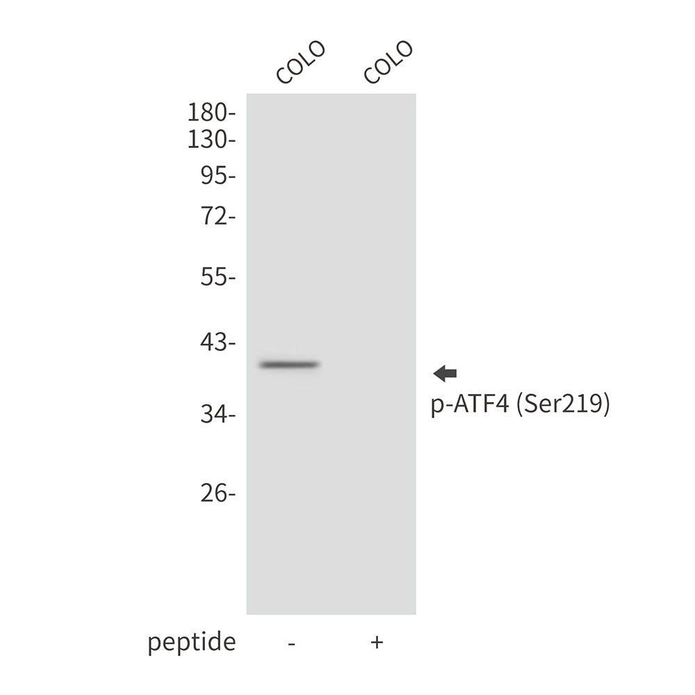 Anti-Phospho-ATF4 (Ser219) Rabbit Polyclonal Antibody