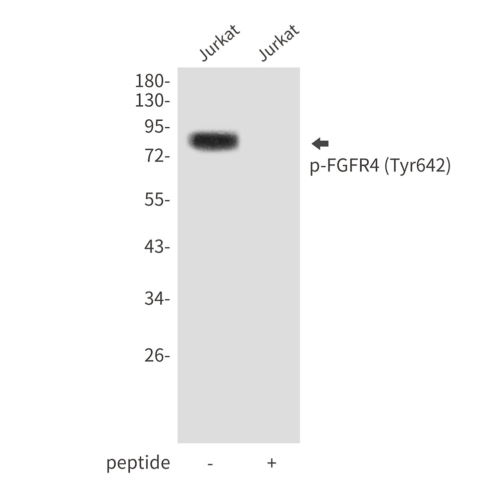 Anti-Phospho-FGFR4 (Tyr642) Rabbit Polyclonal Antibody