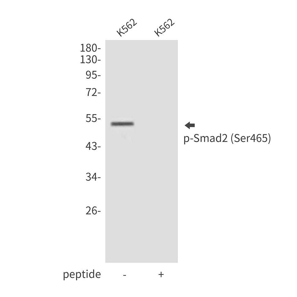Anti-Phospho-Smad2 (Ser465) Rabbit Polyclonal Antibody