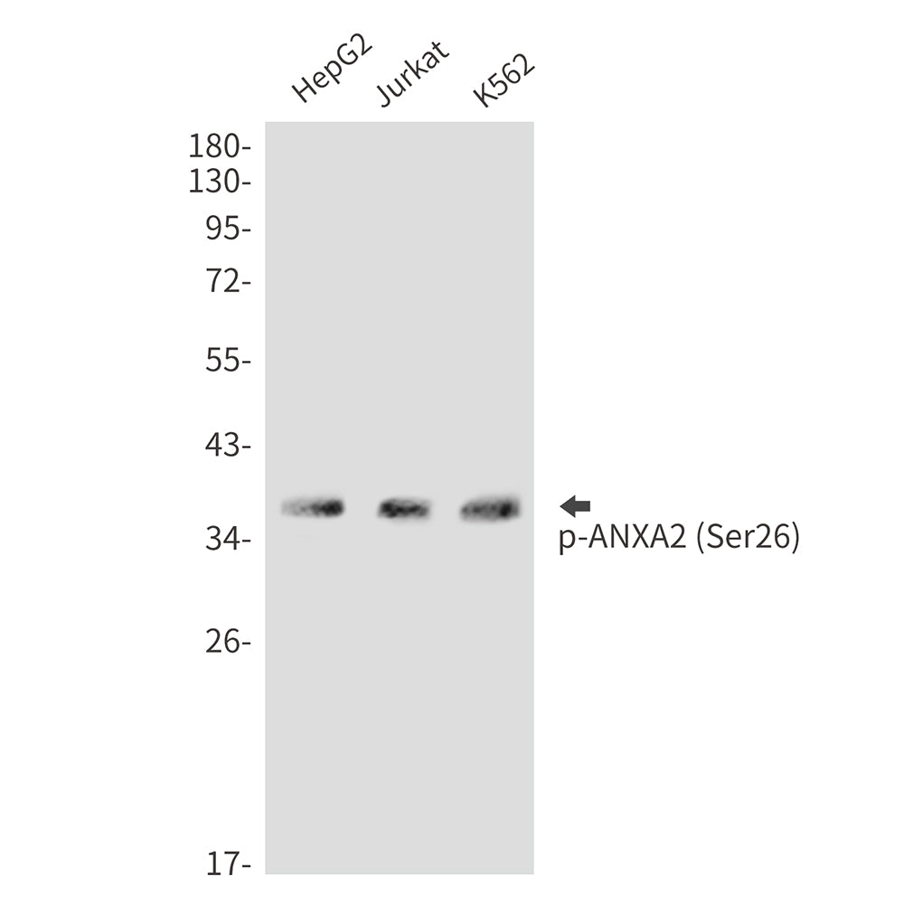 Anti-Phospho-Annexin 2 (Ser26) Rabbit Polyclonal Antibody