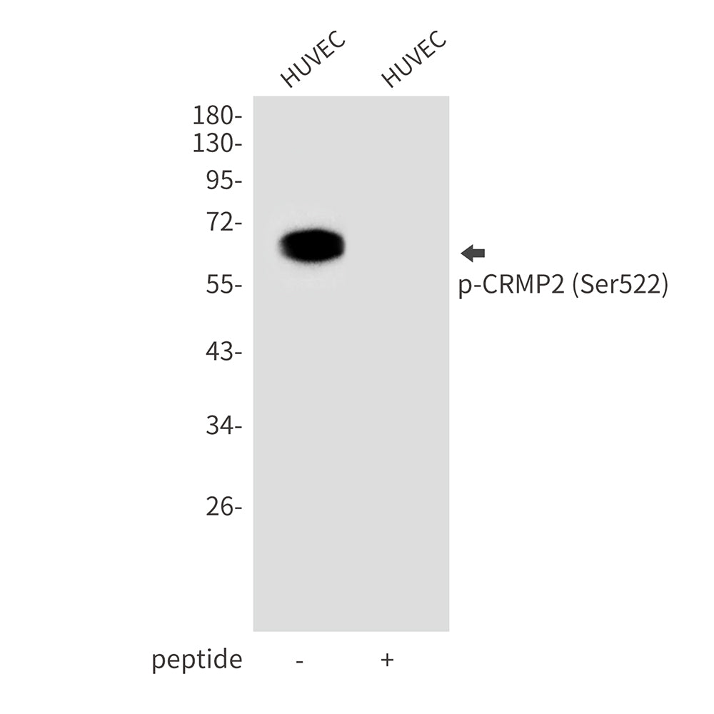 Anti-Phospho-CRMP2 (Ser522) Rabbit Polyclonal Antibody