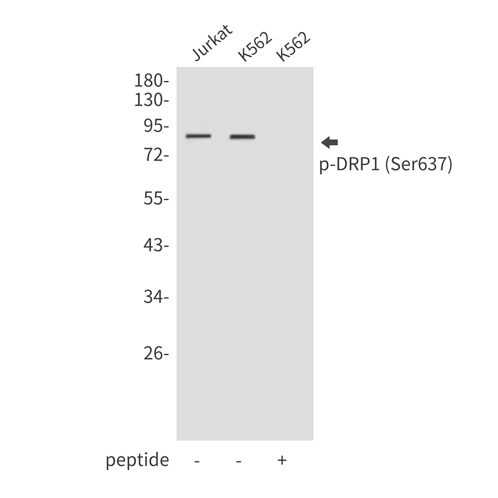 Anti-Phospho-DRP1 (Ser637) Rabbit Polyclonal Antibody