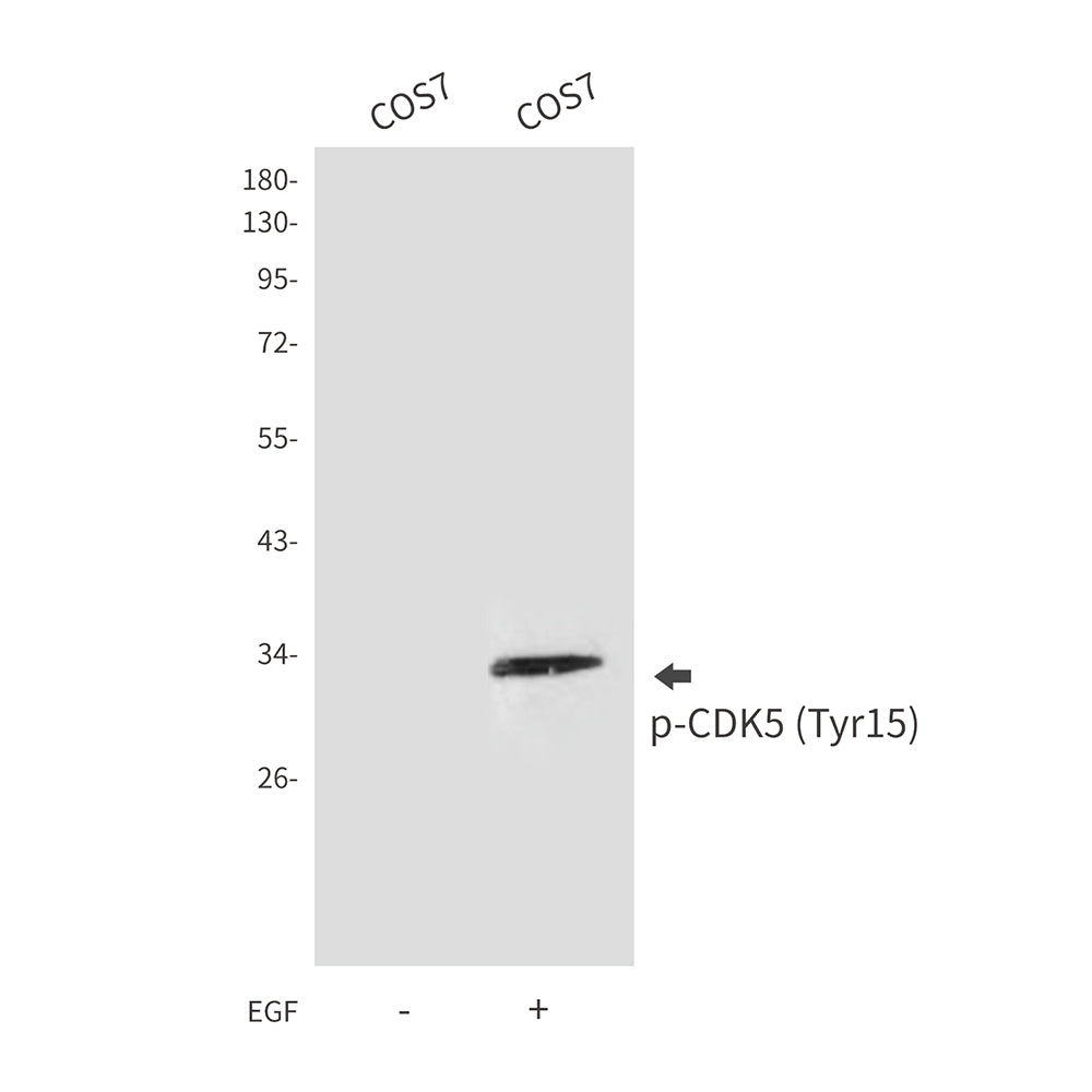 Anti-Phospho-CDK5 (Tyr15) Rabbit Polyclonal Antibody