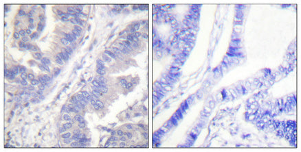 Anti-Phospho-Syk (Tyr348) Rabbit Polyclonal Antibody