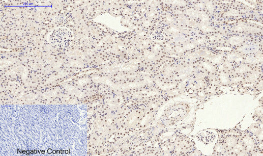 Anti-Phospho-p38 (Tyr323) Rabbit Polyclonal Antibody