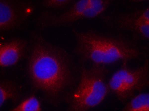 Anti-Phospho-PTEN (Ser380) Rabbit Polyclonal Antibody
