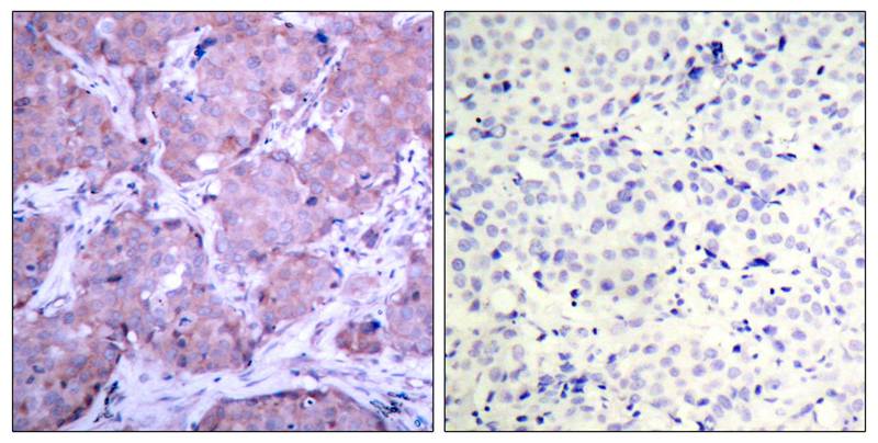 Anti-Phospho-PTEN (Ser380) Rabbit Polyclonal Antibody