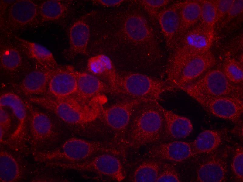 Anti-Phospho-VEGF Receptor 2 (Tyr1175) Rabbit Polyclonal Antibody