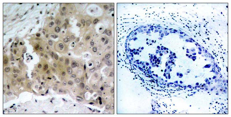 Anti-Phospho-VEGF Receptor 2 (Tyr1175) Rabbit Polyclonal Antibody