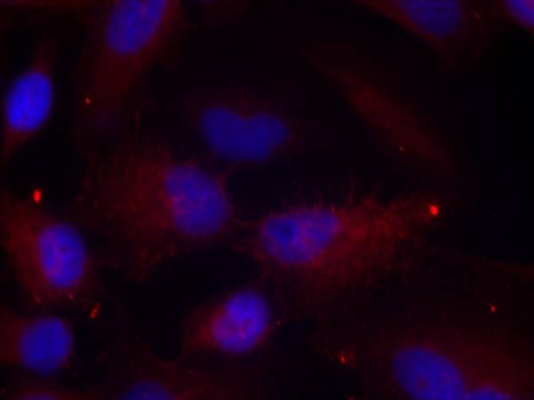 Anti-Phospho-PAK1/2/3 (Thr423/Thr402/Thr421) Rabbit Polyclonal Antibody
