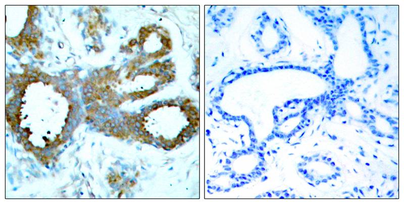 Anti-Phospho-PAK1/2/3 (Thr423/Thr402/Thr421) Rabbit Polyclonal Antibody