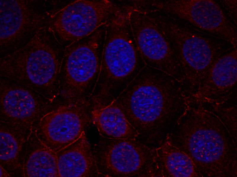 Anti-Phospho-IGF1 Receptor (Tyr1165/Tyr1166) Rabbit Polyclonal Antibody
