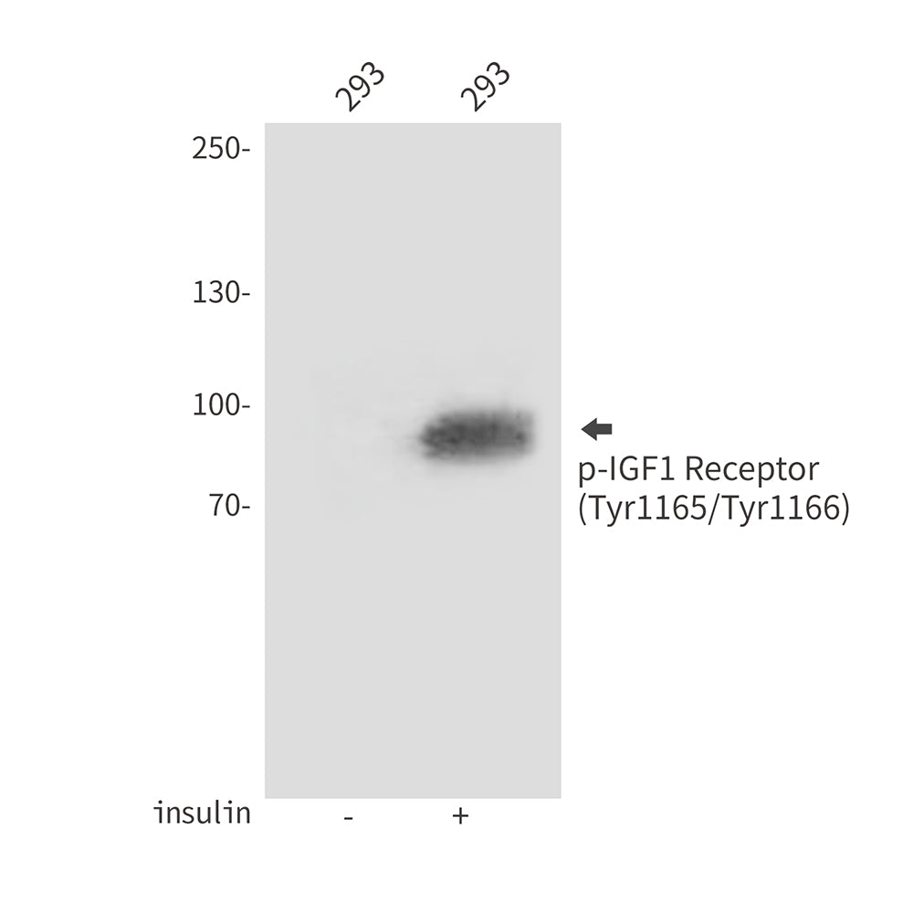 Anti-Phospho-IGF1 Receptor (Tyr1165/Tyr1166) Rabbit Polyclonal Antibody