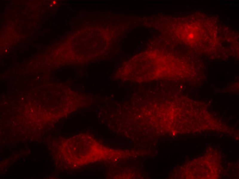 Anti-Phospho-Caveolin 1 (Tyr14) Rabbit Polyclonal Antibody