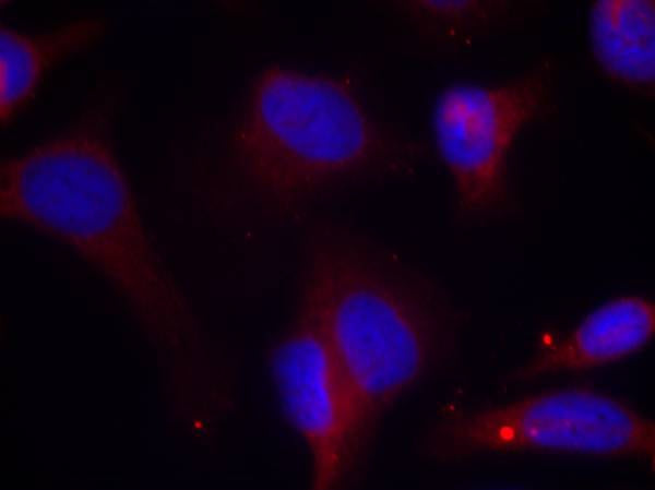 Anti-Phospho-ZAP70 (Tyr319) Rabbit Polyclonal Antibody