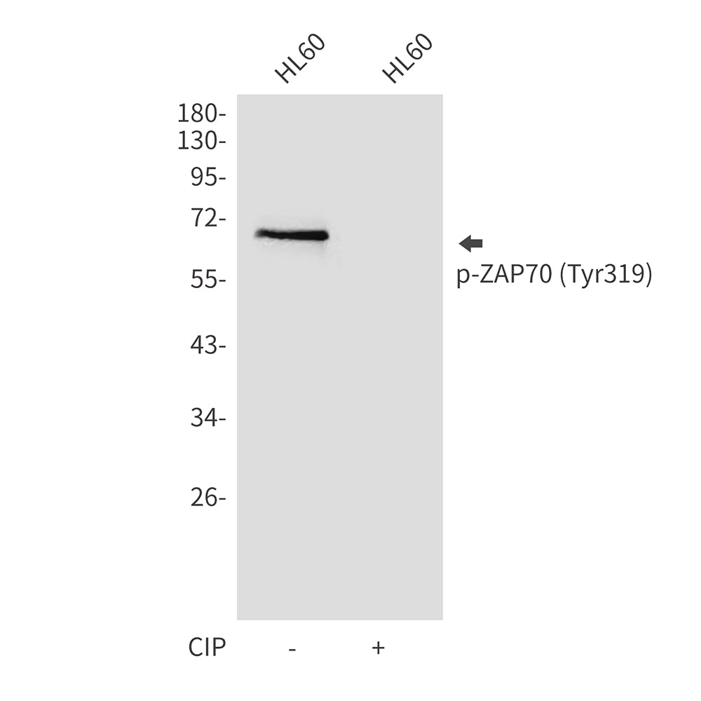 Anti-Phospho-ZAP70 (Tyr319) Rabbit Polyclonal Antibody